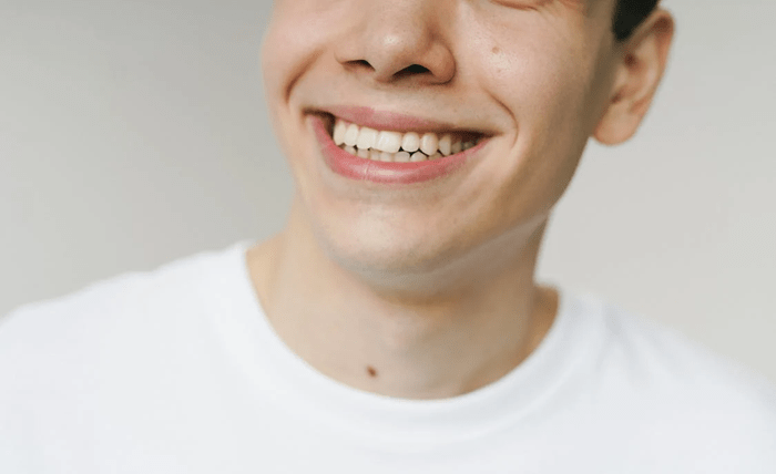 Is Teeth Whitening Safe? Will It Cause Problems? Screenshot 1 8